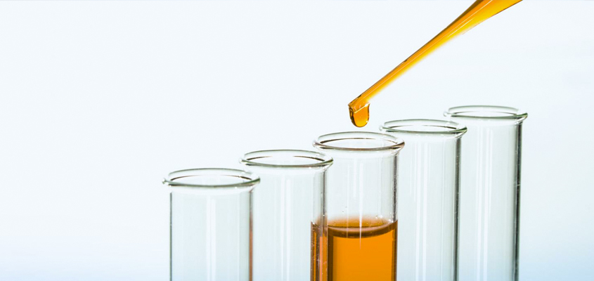 What Are The Benefits Of Regular Oil Analysis?